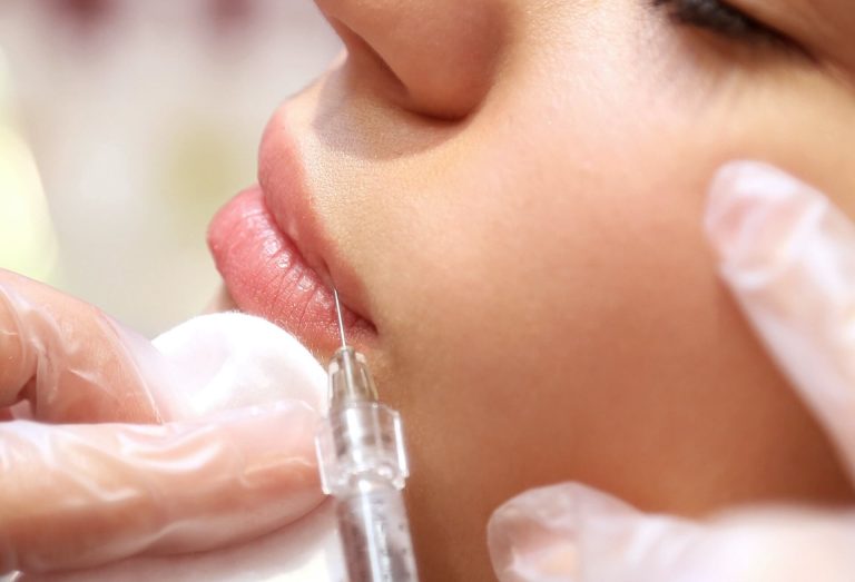 derma fillers