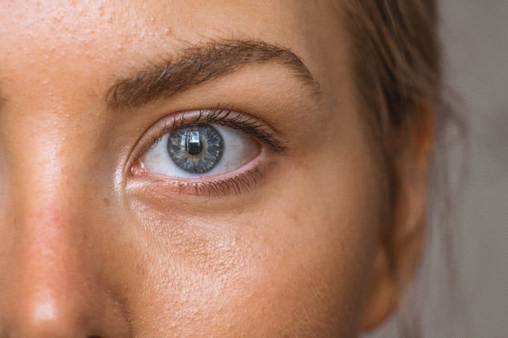 DULL SKIN