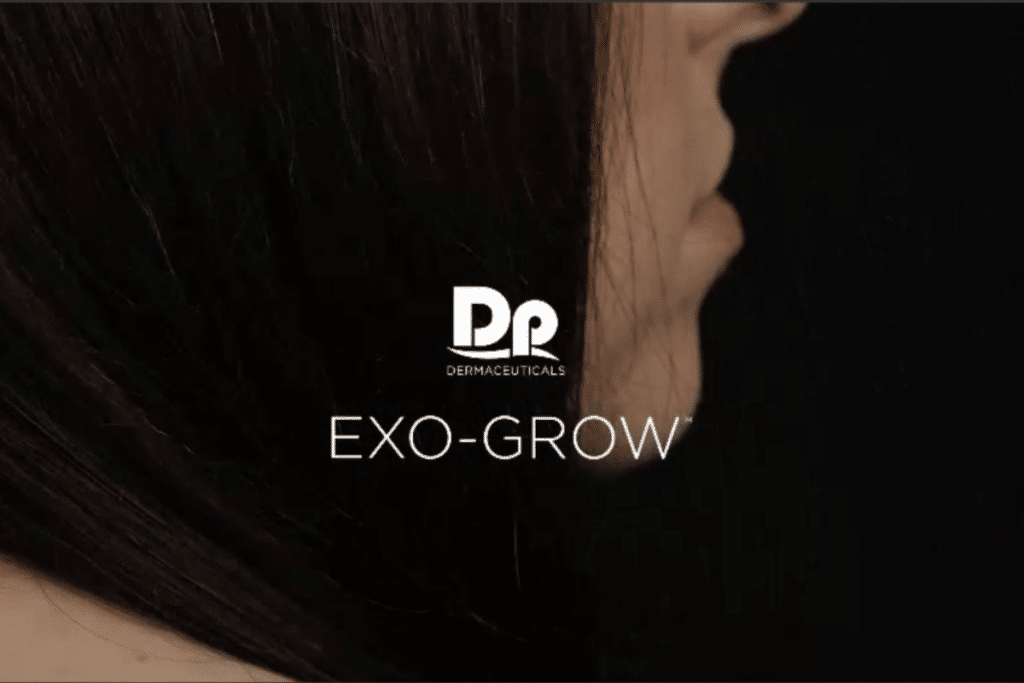 exogrow hair