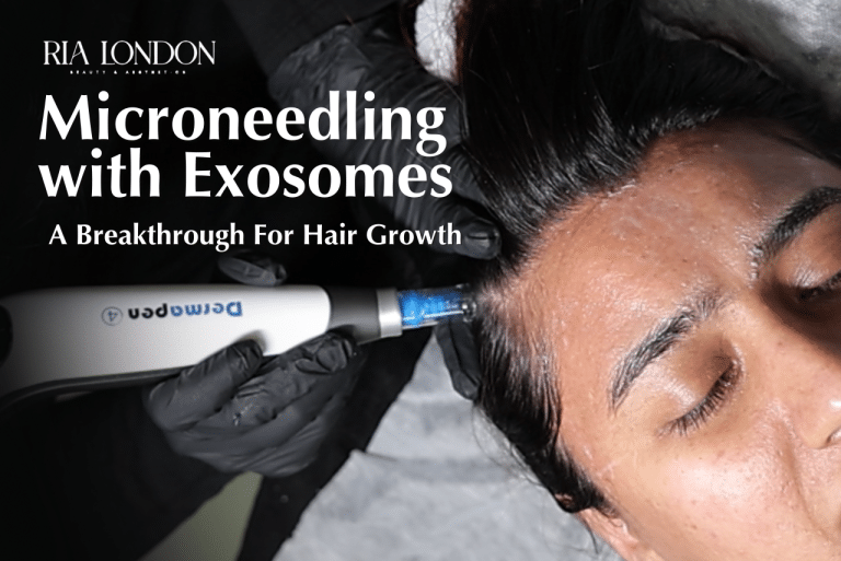 Microneedling With Exosomes: A Breakthrough for Hair Growth